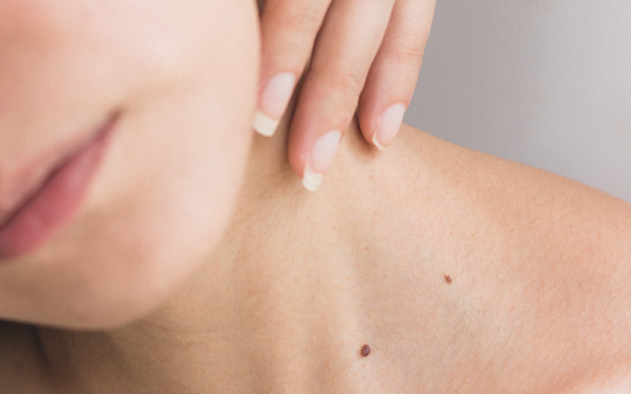 laser hair removal near me, laser hair removal cardiff