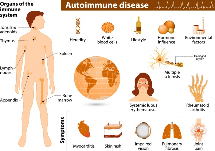 Image result for autoimmune disorders